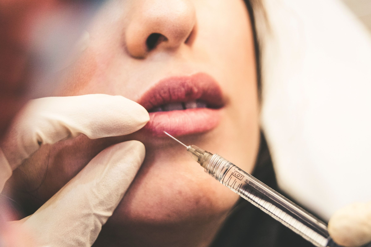 Does Dermal Filler Treatment Last Long? Know Everything About This Treatment