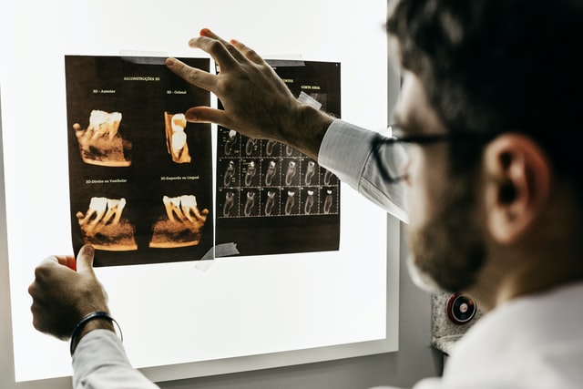 Dental X-rays: Why They’re Important and How to Interpret Them