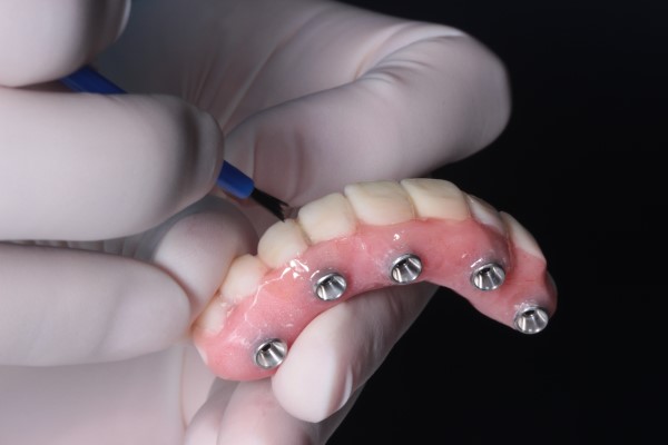 Replace Your Missing Teeth With All On 4 Implants