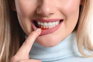 Is It Possible to Treat Gum Disease at Home?